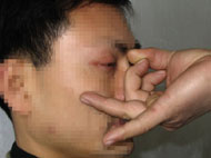 酷刑演示:弹眼球