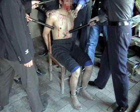'酷刑演示:电击'