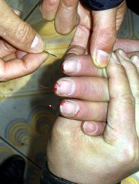 '酷刑折磨:针刺手指'