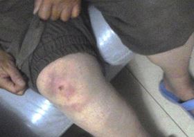 '唐玉被毒打,头部、两臂和大腿均受伤'